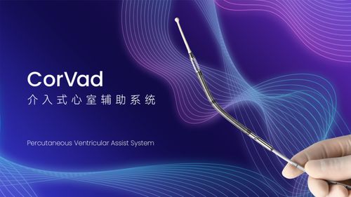 國產創新突破 深企介入式心室輔助系統獲批上市，填補國內技術空白